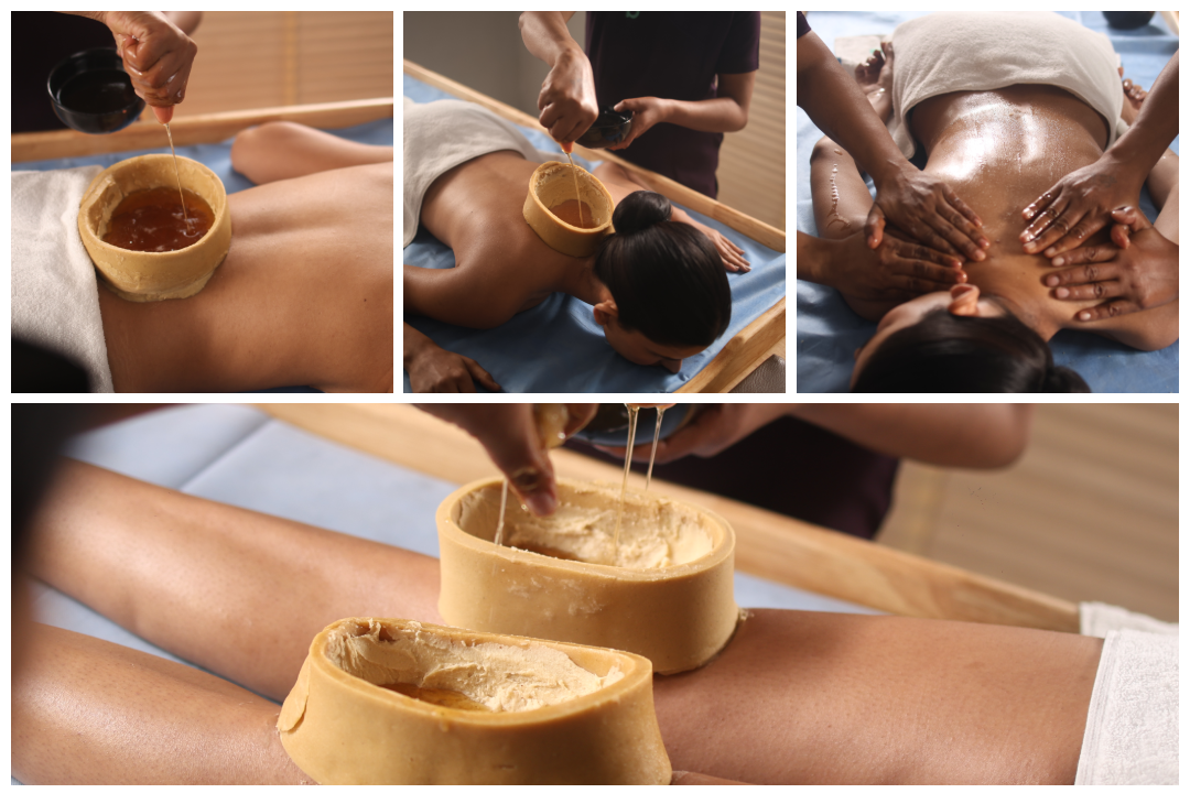 Basti Panchakarma therapy being administered at Ayutirth Ayurveda Ahmedabad